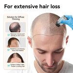 Derma Stamp Manufacturer - Hydra Needle 25 for Hyaluronic Therapy Home Use