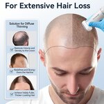 Bio Roller Manufacturer - 120 Needles Adjustable Derma Stamp