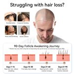 Microneedling Device Manufacturer - Bio 120 Painless Absorption Derma Stamp