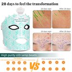 7 Color LED Facial Mask - Portable 80 Beads 240 Lights Professional Skin Care