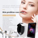 Portable 3D AI Scanner - Intelligent Skin Image Analyzer Diagnostic Test Device