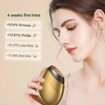 RF Facial Beauty Device - MFIP EMS Microcurrent Pulse Wrinkle Removal Face Lifting