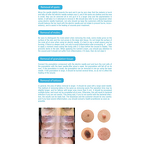 2 in 1 Plasma Pen - Best Fibroblast Ozone Therapy Eyelid Lifting Mole Removal Tool