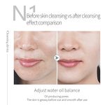 Oxygen Magic Bubble Machine - Facial Cleaning Skin Management Salon Instrument