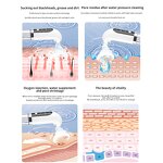 Small Bubble Blackhead Remover - 2024 New Arrival Water Cycle Electric Vacuum Cleaner