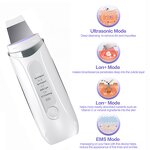Ultrasonic Skin Scrubber - Professional Blackhead Removal Pore Cleansing Anti-aging Device