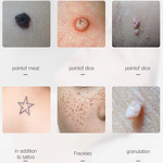 Plasma Pen - Spot Mole Removal Fibroblast LCD Skin Tag Freckle Wart Remover