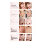 Multifunctional Aqua Peeling Machine - Beauty SPA RF Skin Tightening Facial Deep Cleaning