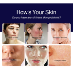 Multifunctional Aqua Peeling Machine - Beauty SPA RF Skin Tightening Facial Deep Cleaning