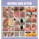 M22 2-in-1 Beauty Machine - 3000W IPL OPT Nd Yag Hair Tattoo Removal