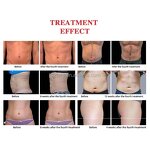 Hiemt Pro Max Machine - Portable EMS Body Sculpting Neo with Pelvic Repair