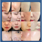 Morpheus8 Facial Machine - Portable High Radio Frequency Skin Rejuvenation Face Lift