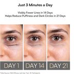 Eye Massager Manufacturer - OEM ODM 4-in-1 Red Light Therapy Heating Vibration for Reduce Puffiness Dark Circles