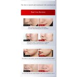 Collagen Gun Manufacturer - 2025 New EMS Anti-aging Wrinkle Remover Home Microcurrent Facial Firming