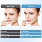 Beauty Device Manufacturer - Factory Sale EMS Red Blue Light Skin Rejuvenation Vibration Anti-Wrinkle V Face