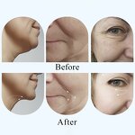 Facial Sculpting Machine Manufacturer - Customized EMS Vibration LED Red Light Therapy Neck Care Skin Tightening