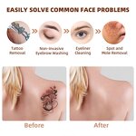 Mini Nd Yag Laser - Second Gen No Water Eyebrow Washing Carbon Peeling Tattoo Tool