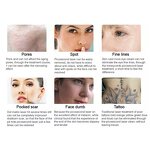 Mini Pico Laser Machine - New Arrival Q Switch Nd Yag Clinic Tattoo Removal Tool