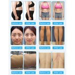 9 in 1 Slimming Machine - Hot Sale RF Vacuum 40k Cavitation Laser Fat Reduce System