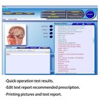 3D NLS Quantum Analyzer - 2023 Hot Sale Bio Resonance Magnetic Body Health Machine