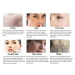 Carbon Peeling Laser - 2025 Best Selling Picosecond Nd Yag Skin Whitening Machine