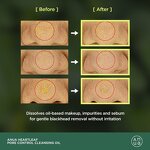 Heartleaf Cleansing Oil - 2024 Korean Facial Cleanser Makeup Blackheads Removal Tool