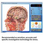 3D NLS Quantum Analyzer - 2023 Hot Sale Bio Resonance Magnetic Body Health Machine