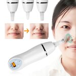Diamond Microdermabrasion Machine - Hot Sale Portable Handheld Vacuum Peeling Rejuvenation Tool