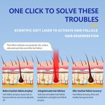 Hair Growth Helmet Manufacturer - Wireless Use LED Light Treatment Red Light Therapy for Home