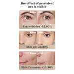 PDT Phototherapy Machine Manufacturer - 7 Color LED Wireless for Tender Skin