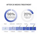 Red Light Hair Regrowth Helmet Manufacturer - 272 Pcs Diodes LED Red Light Rejuvenation Cap