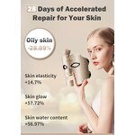 PDT Phototherapy Machine Manufacturer - 7 Color LED Wireless for Tender Skin