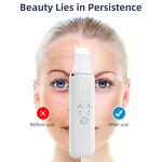 Ultrasonic Skin Scrubber - OEM New Design Limpiador De Piel Sonic Spatula Tool