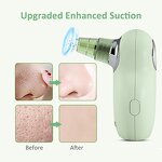 Blackhead Remover Vacuum - Beauty Products Pore Cleaner Acne Blackheads Tool