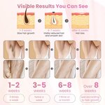 IPL Laser Hair Removal - Home Facial Permanently High Power Portable Epilation Tool