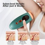 IPL Laser Hair Removal - Factory Direct Green Portable Home Epilator for Women