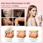 IPL Laser Hair Remover - Hot Selling Painless Home Use Hand Leg Epilator Device