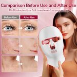 7 Color Facial Mask - 2026 Rechargeable Skin Scrub Acne Anti Aging Beauty Device