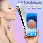 Blackhead Remover Kit - Electric Wireless Camera Facial Nose Pore Cleaning Tool