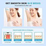Mini IPL Hair Removal Device - Best Seller Women Ice Cooling Home Laser Handset