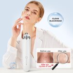 Blackhead Suction Vacuum - OEM Portable Face Pore Deep Cleansing Comedo Remover