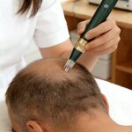 Microneedle Derma Pen Manufacturer - Home MTS Powered Adjustable NANO Needle Length for Acne Lip Face