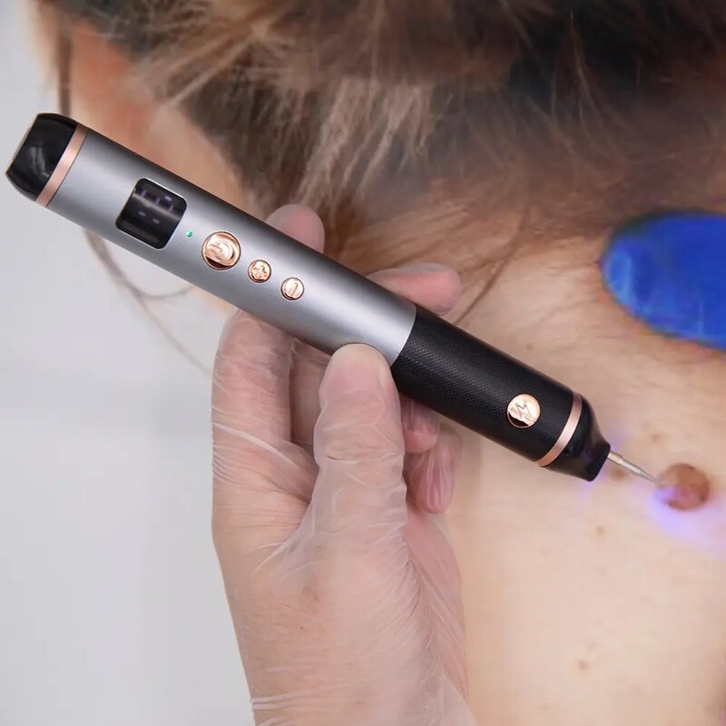 Electric Derma Pen Stamp - Adjustable Frequency Hair Growth Stretch Marks US Plug