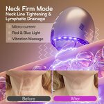 Derma Roller System - Custom 540 0.5mm Titanium Beard Hair Face Skin Care Tool