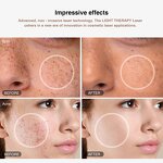 Laser Hair Growth Helmet - 655nm 850nm Infrared Scalp Care Anti Hair Loss Device