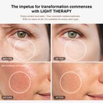 Mesotherapy Ampoule Cartridges - Wholesale 0.3 0.5ML Replacement Syringes Kit