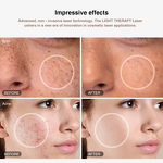 8 Color LED Light Therapy Mask - Dr.bioled Silicone Infrared Facial Neck SPA Tool