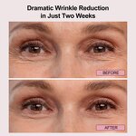 8 Color LED Light Therapy Belt - Silicone Infrared PDT Body Face Rejuvenation Tool