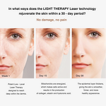 2 in 1 Microneedling Derma Roller - 48 540 Titanium Needles Eye Face Acne Marks Tool