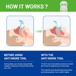 Scalp Massage Tool - Custom Wholesale 5ML Mini Hair Growth Serum Applicator Comb